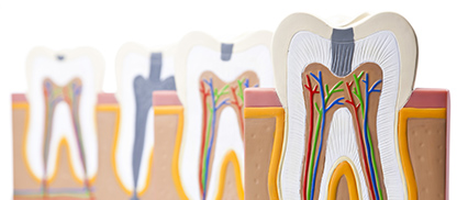 歯肉から血が出る、歯がぐらぐらする 歯周病