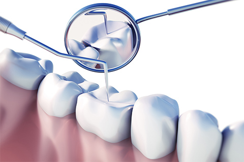 痛みの少ない治療