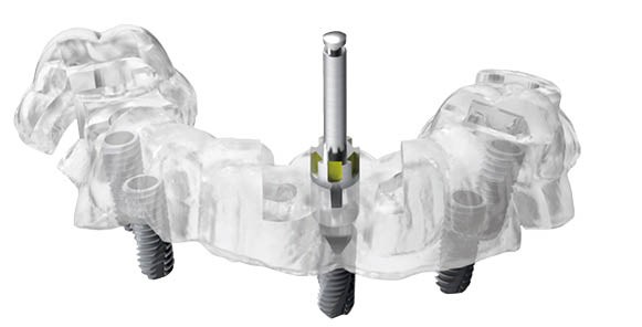 サイナスリフト