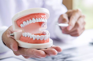 マウスピース矯正