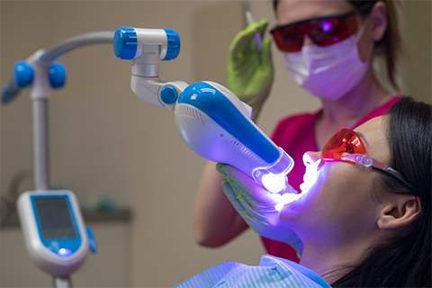 オフィスホワイトニング